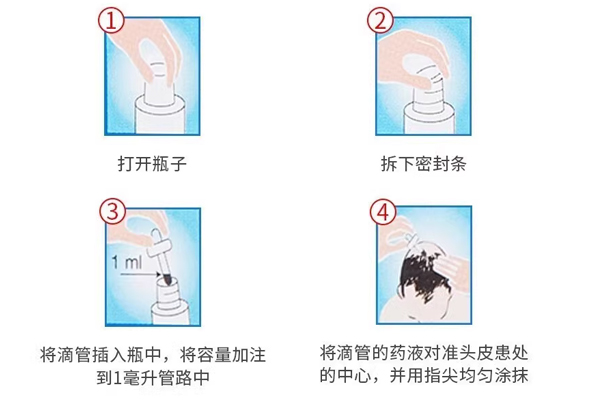 印度hair4u生發液的正確使用方法指南