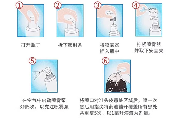 印度hair4u生發液的正確使用方法指南